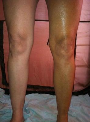 Left leg no tan/ Right leg Knockout Tan