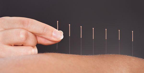 Cindy Nilson Acupuncture