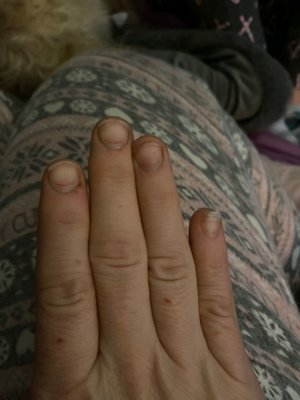 Absolutely destroyed my nail bed underneath by using the grinder on my nails. The nails didn't even last a week on.