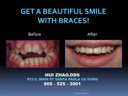 Hui Zhao, DDS