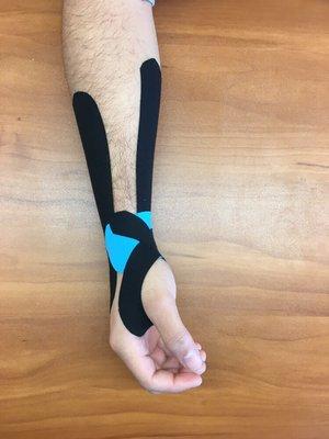 Carpal Tunnel Kinesio Taping