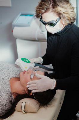 Laser treatments to help reduce Wrinkles, Fine Lines, Sun Damage, Pigmentation, Vessels