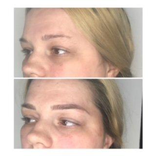 Beth's Before and After Microblading Picture from review.