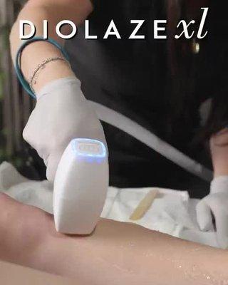 Diolaze Xl - Hair Removal