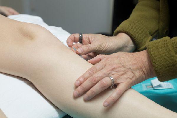 Pain-free Japanese Acupuncture -- Easthampton, MA