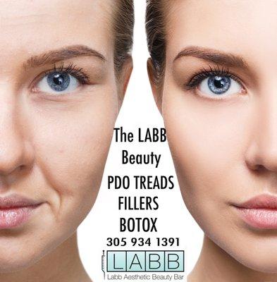 BOTOX and Fillers