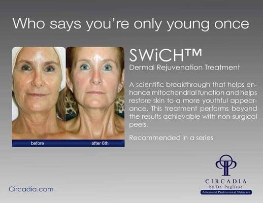 Swich treatment  $125