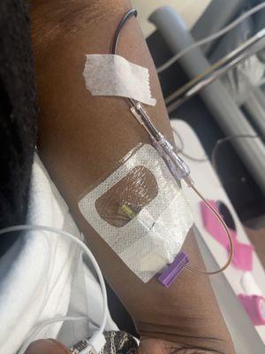 Iron infusion treatments went smoothly.