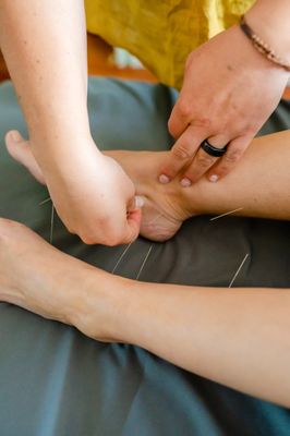 Dr. Lyndsey Maher, Naturopathic Doctor, holds a Master's degree in acupuncture and utilizes this modality often in practice.