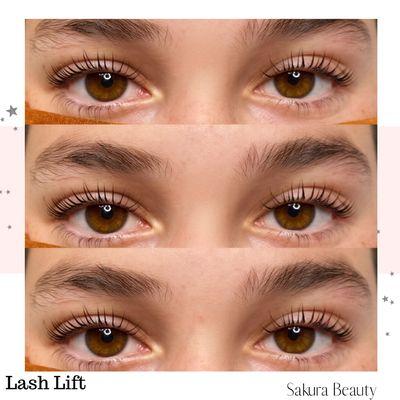 Lash Lift