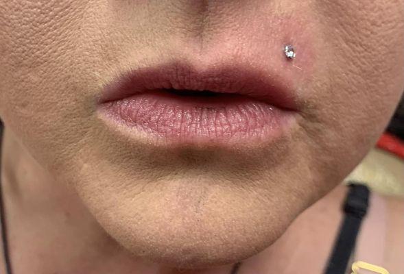 This is a top lip piercing by Alex (Smorez) Berry