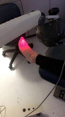 Laser for fungus toenails.