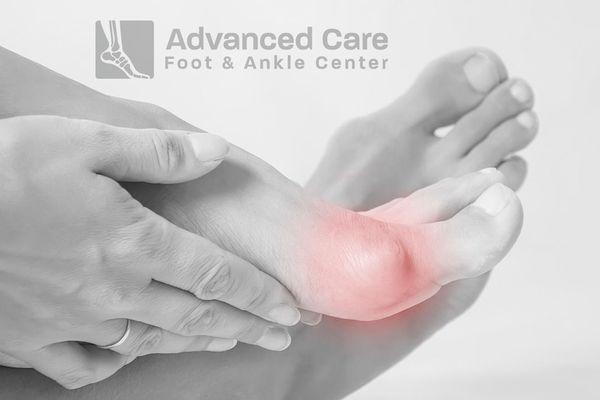 Bunion pain? If left untreated, it can lead to further complications.