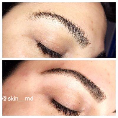 Brow maintenance