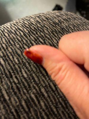 Dark spot on corner of thumb nail.