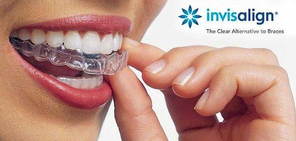 Now offering the clear alternative to braces