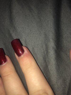 They cut me along the side of my nail, now red, puffy, and painful as hell