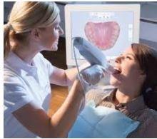 We use digital scanner for invisalign and implants instead of taking impressions.