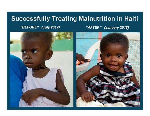 Nutritional supplements help overcome severe childhood malnutrition, which is a major cause of childhood deaths in Haiti.