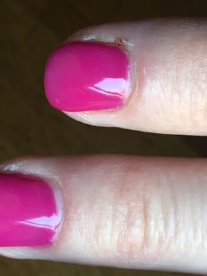 This is only 1 day after...you can see that it's not back to the cuticle, and you can see where she cut me.