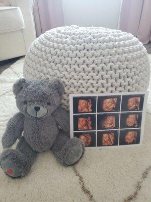 Our 3D/4D images and the sweet heartbeat bear we received as a part of one of the packages- highly recommend!