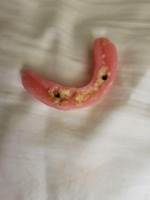 This is what my lower denture looks like after 1 meal.