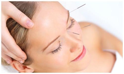 We offer cosmetic acupuncture and facial rejuvenation services.