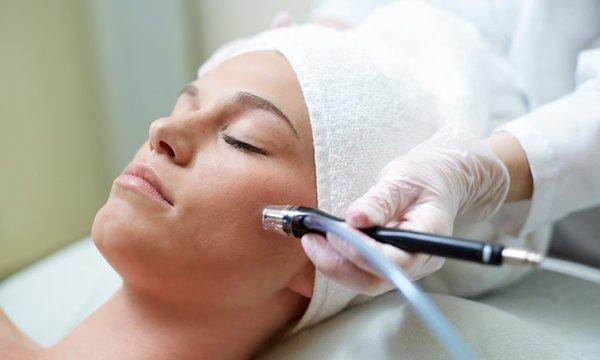 Microdermabrasion