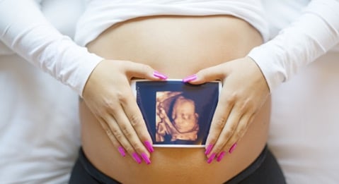 A 3D/4D ultrasound gives you an Early bonding experience with your baby.  These moments last a lifetime.