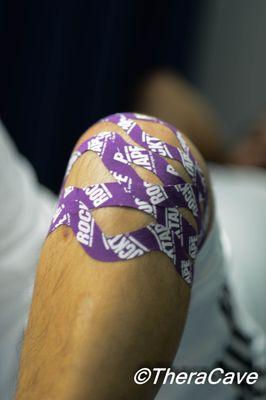 Knee taping