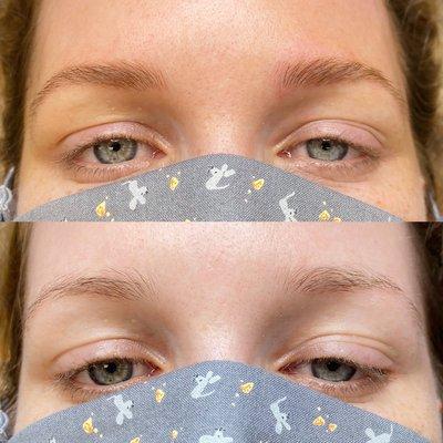 Microblading