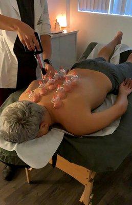 Cupping therapy