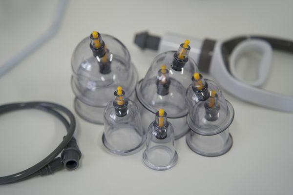 Cupping Therapy