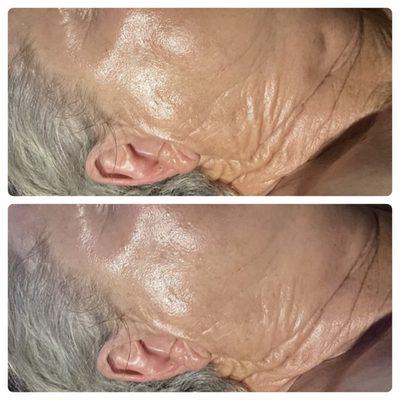 Amazing results with the firming peptide mask! Helps, lift, tighten & reduce Wrinkles and fine lines. Check out her neck area! Just wow!