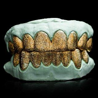 Grillz by Solez 864 gold grill