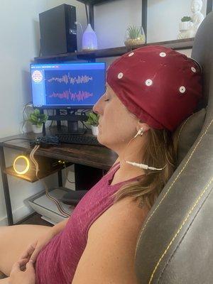 QEEG Brainmap