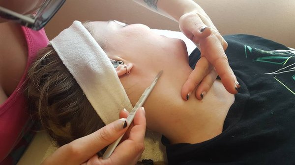 Dermaplane Exfoliation