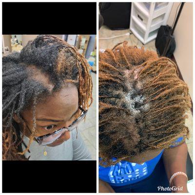 This client suffers from thinning hair on the top of her head. I added density to her scalp to give a more fuller look.