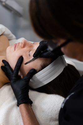 Dermaplaning at Vita Nova