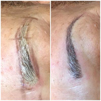 Microblading