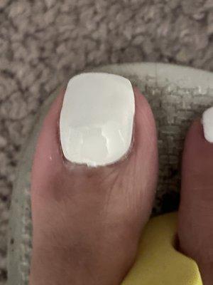 Hope the picture can capture the lumpiness of the acrylic and how it is not even properly applied around the cuticle.