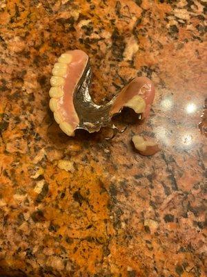 Broken denture I need fix ~?