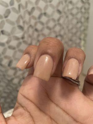 Cuticles fried