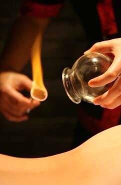 Cupping therapy