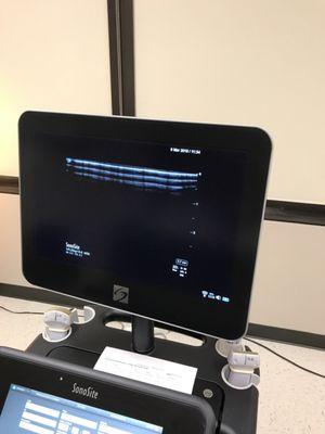 Ultrasound used to guid the treatments