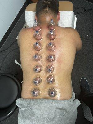 CUPPING AVAILABLE