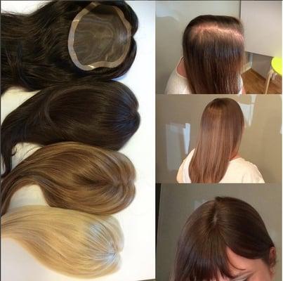 Great solutions for women's hair loss! We provide women with toppers that can be clipped in, taped on or bonded!