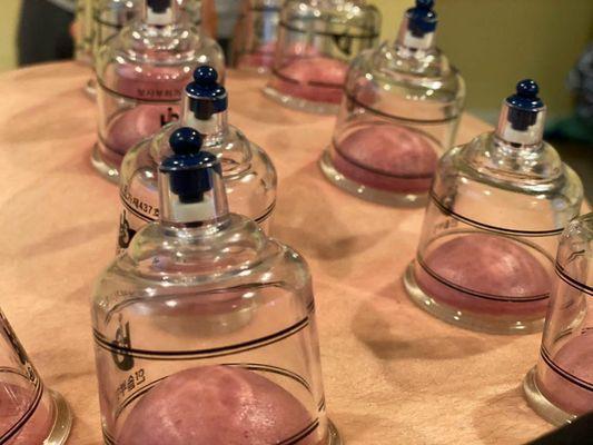 Cupping therapy