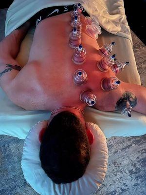 Cupping