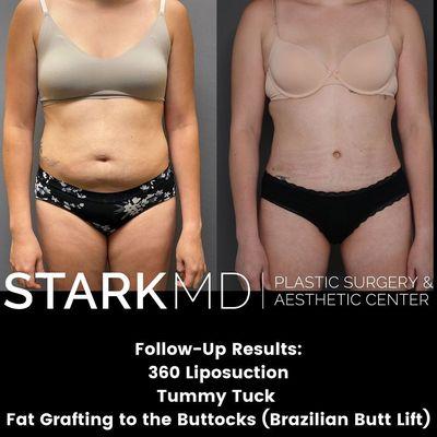 StarkMD Plastic Surgery and Aesthetic Center